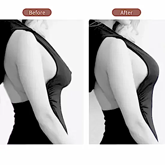 Göğüs Dikleştirme Bandı S Beden 2.5 Cm.